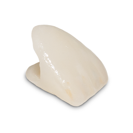 Porcelain Crown